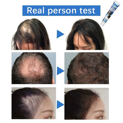 Buy Sumifun Hair Growth Cream Best Treatment for Hair Loss & regrowth