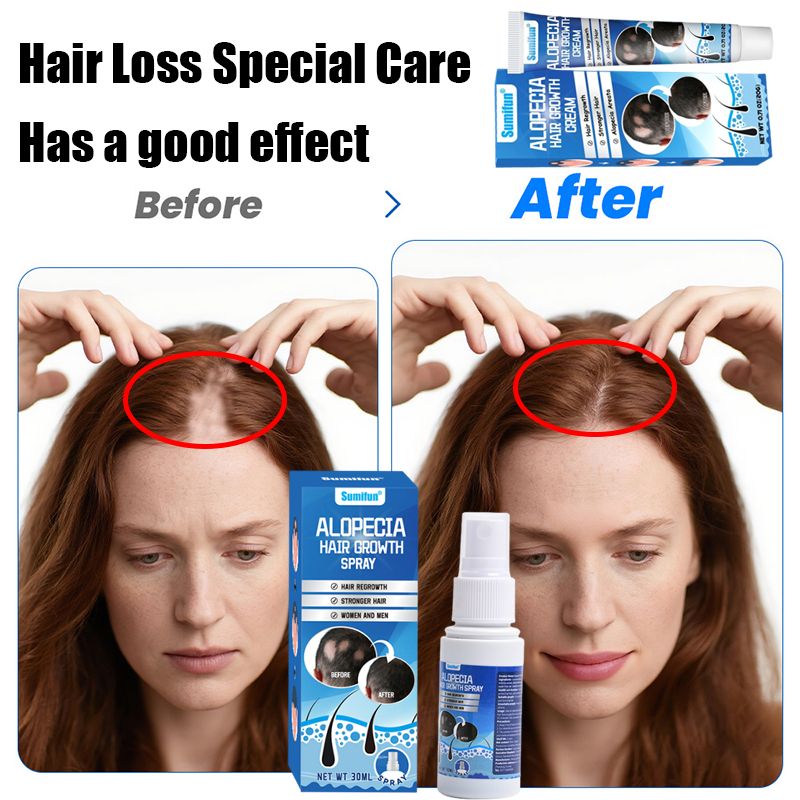 Buy Sumifun Hair Growth Cream Best Treatment for Hair Loss & regrowth